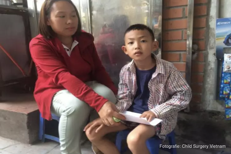 Child Surgery Vietnam maakt een einde aan operatie achterstanden bij kinderen